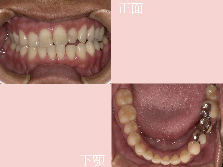 Before