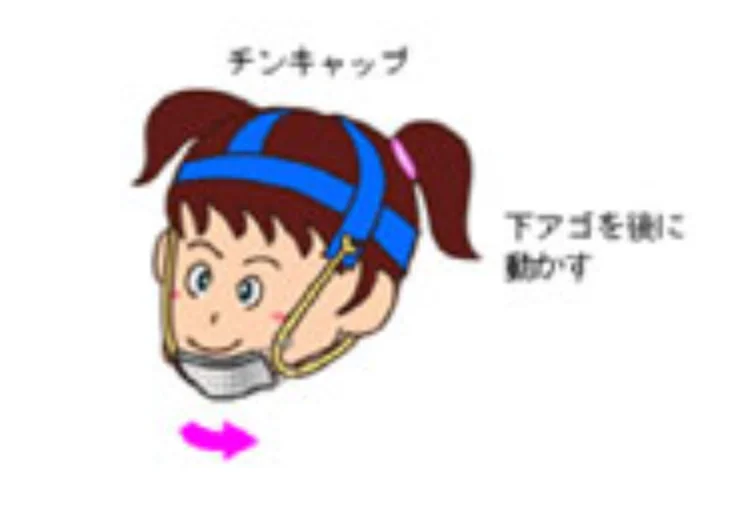 小児矯正の機材