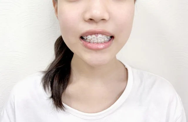 3730111_s-1 大人の矯正