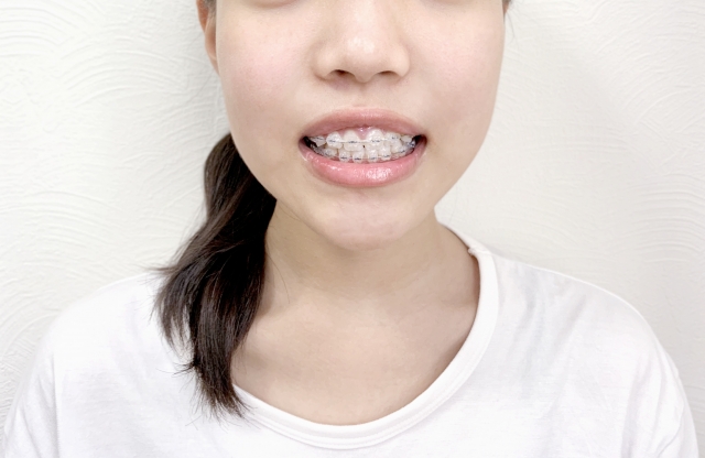 大人の矯正
