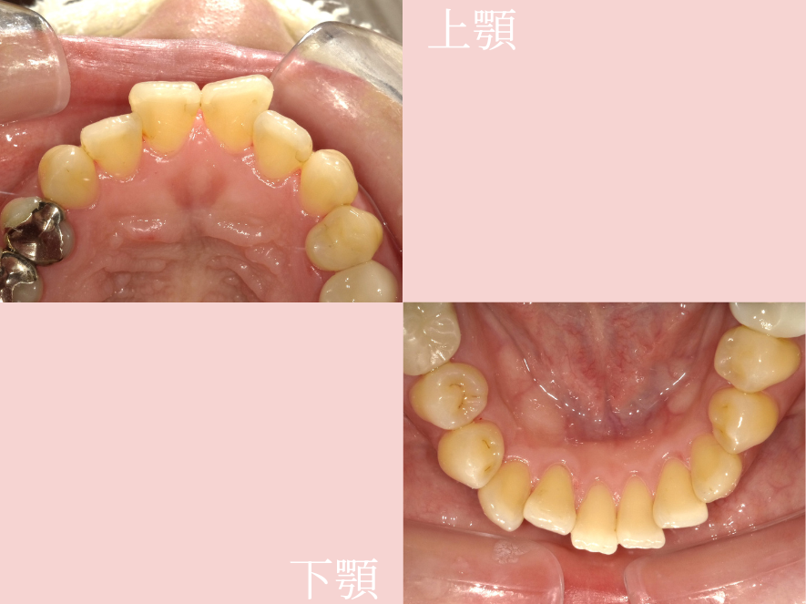 After