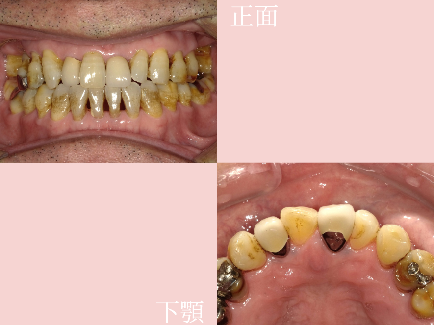 Before