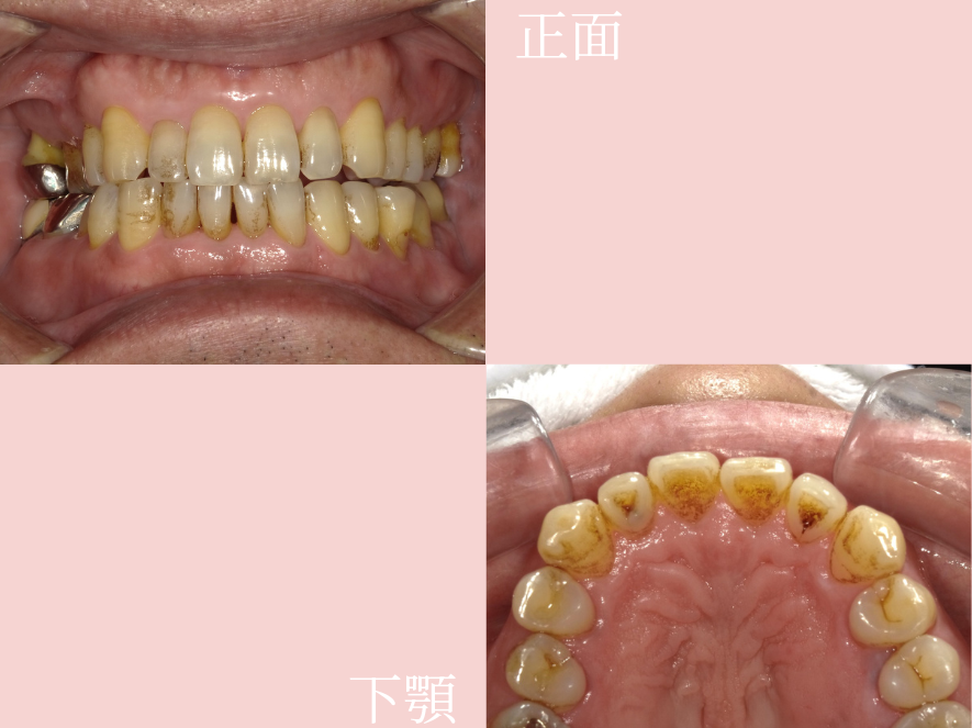 Before