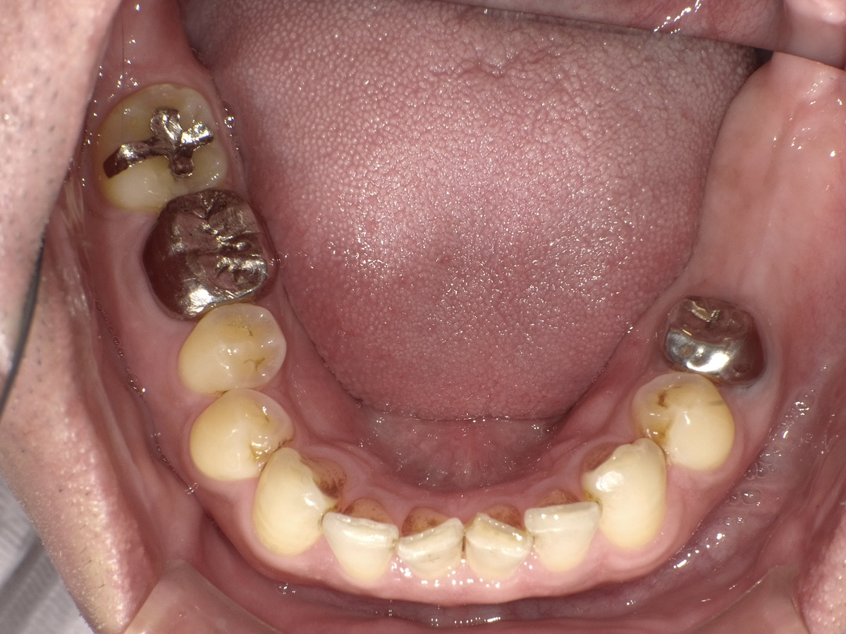 Before