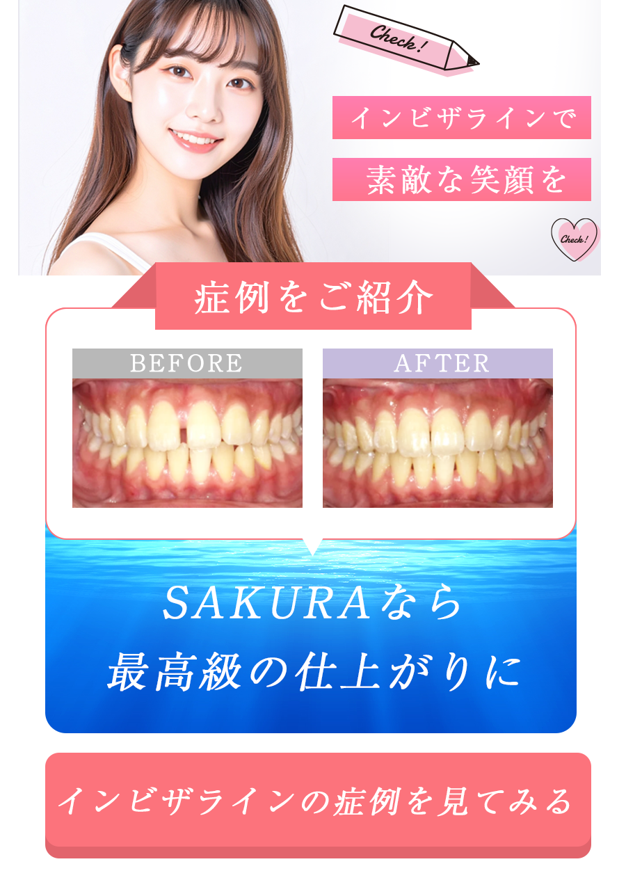 インビザラインの症例ポップアップ