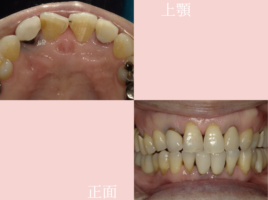 After