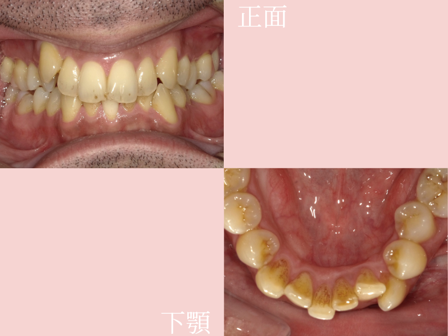 Before