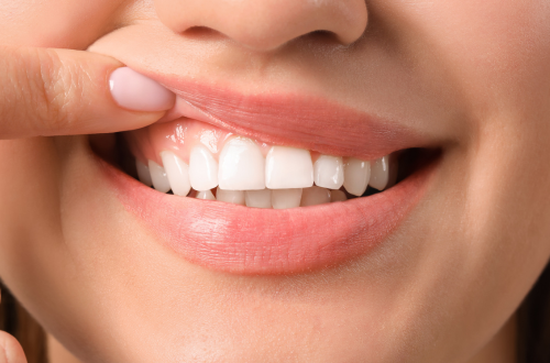 根本治療と生活習慣指導